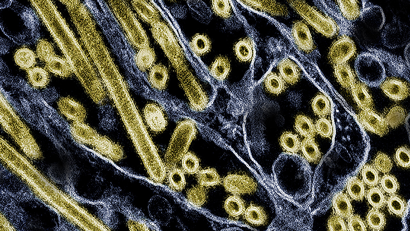 高病原性鳥インフルエンザウイルス（H5N1亜型）の顕微鏡画像（NIAID＝米国立アレルギー感染症研究所）